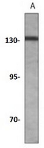 TRK B Recombinant Rabbit Monoclonal Antibody