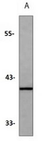 Doublecortin Antibody in Western Blot (WB)