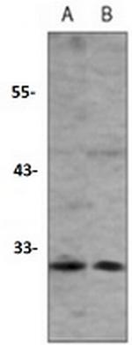 CD273 Recombinant Rabbit Monoclonal Antibody