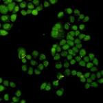 CDK2 Recombinant Rabbit Monoclonal Antibody