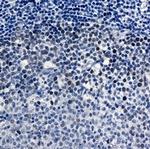 CDK2 Antibody in Immunohistochemistry (Paraffin) (IHC (P))