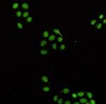 NAT10 Antibody in Immunocytochemistry (ICC/IF)