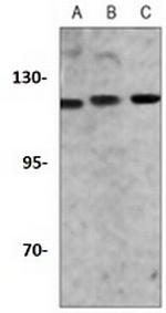 NAT10 Antibody in Western Blot (WB)