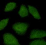 Importin 9 Recombinant Rabbit Monoclonal Antibody