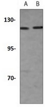 Importin 9 Antibody in Western Blot (WB)