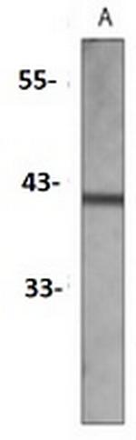 AT1 Recombinant Rabbit Monoclonal Antibody