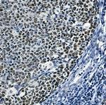 CDC46 Antibody in Immunohistochemistry (Paraffin) (IHC (P))