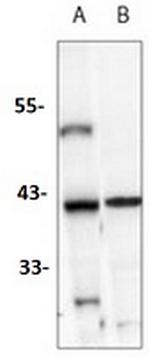 IKB alpha Recombinant Rabbit Monoclonal Antibody