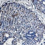 TCF6 Antibody in Immunohistochemistry (Paraffin) (IHC (P))