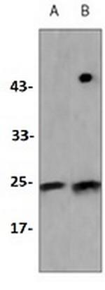 TCF6 Antibody in Western Blot (WB)