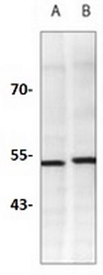 WTAP Antibody in Western Blot (WB)