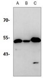 PGD Antibody in Western Blot (WB)