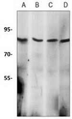 MLH1 Recombinant Rabbit Monoclonal Antibody