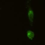 CD91 Recombinant Rabbit Monoclonal Antibody