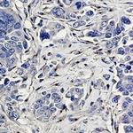 CD91 Antibody in Immunohistochemistry (Paraffin) (IHC (P))