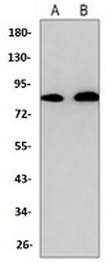 CD91 Antibody in Western Blot (WB)