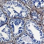 Caveolin 1 Antibody in Immunohistochemistry (Paraffin) (IHC (P))