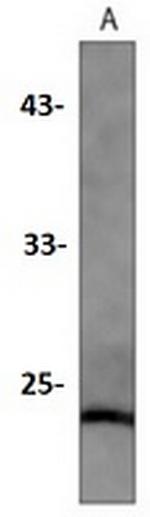 Caveolin 1 Antibody in Western Blot (WB)