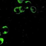PI3K p85 alpha Antibody in Immunocytochemistry (ICC/IF)