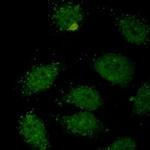 SMAD3 Recombinant Rabbit Monoclonal Antibody