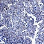 SMAD3 Antibody in Immunohistochemistry (Paraffin) (IHC (P))