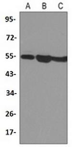 SMAD3 Antibody in Western Blot (WB)