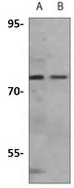 Eif2ak2 Antibody in Western Blot (WB)