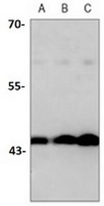 TGFB1 Recombinant Rabbit Monoclonal Antibody