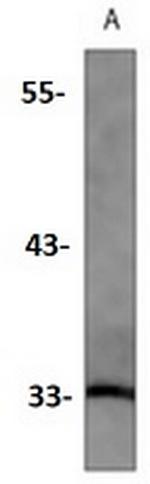 Hmox1 Antibody in Western Blot (WB)