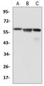 MYC Antibody in Western Blot (WB)