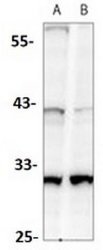 CASP3 Antibody in Western Blot (WB)
