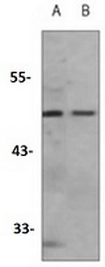 CASP9 Recombinant Rabbit Monoclonal Antibody
