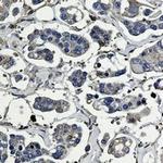 ARPC5 Recombinant Rabbit Monoclonal Antibody