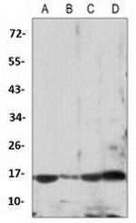 ARPC5 Antibody in Western Blot (WB)
