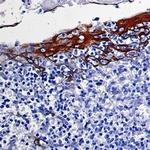 KRT10 Recombinant Rabbit Monoclonal Antibody