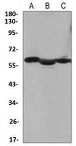 KRT10 Antibody in Western Blot (WB)