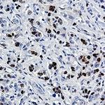 SOX9 Recombinant Rabbit Monoclonal Antibody