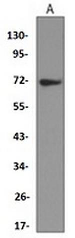 SOX9 Antibody in Western Blot (WB)