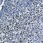 Phospho-NFE2L2 (Ser40) Recombinant Rabbit Monoclonal Antibody