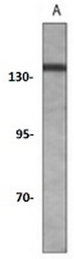Phospho-RBL2 (Thr986) Recombinant Rabbit Monoclonal Antibody