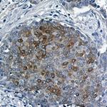 Phospho-EIF4EBP1 (Thr46) Antibody in Immunohistochemistry (Paraffin) (IHC (P))