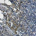 ENO1 Antibody in Immunohistochemistry (Paraffin) (IHC (P))