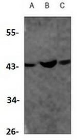 ACADS Recombinant Rabbit Monoclonal Antibody