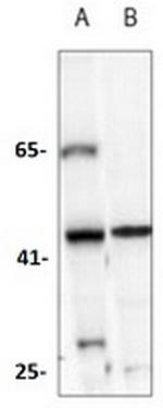 ACAT1 Recombinant Rabbit Monoclonal Antibody