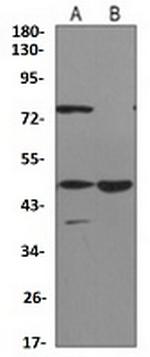 ACOX1 Antibody in Western Blot (WB)
