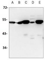 ADSS2 Antibody in Western Blot (WB)