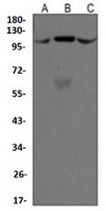 PDCD6IP Recombinant Rabbit Monoclonal Antibody