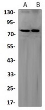 ALPL Antibody in Western Blot (WB)