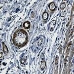ACTA2 Antibody in Immunohistochemistry (Paraffin) (IHC (P))