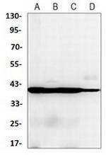ACTA2 Antibody in Western Blot (WB)